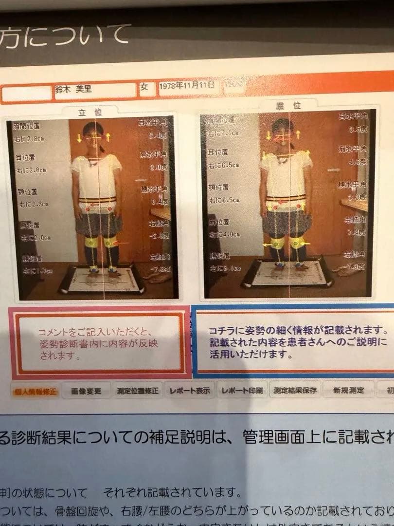 ゆがみーるlite 姿勢解析