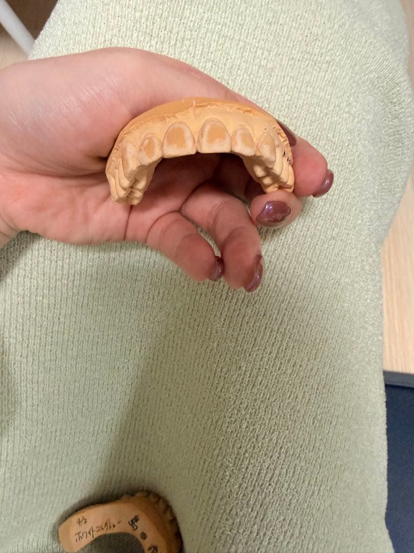 歯の模型 手のひらサイズ
