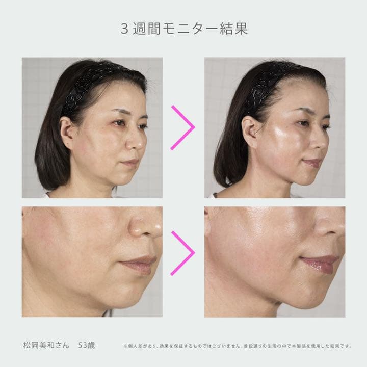 顔用EMS フェイスデボーテ